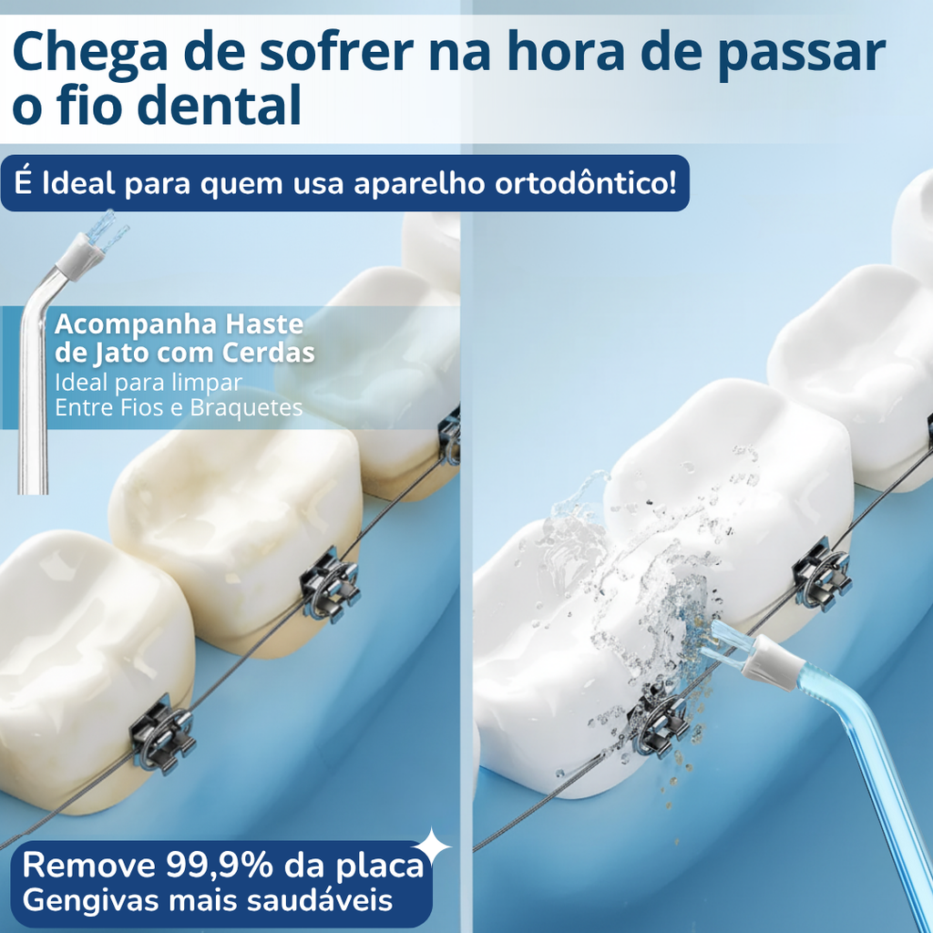 Aparelho Irrigador Oral Bucal Dental Jet Limpeza Portátil