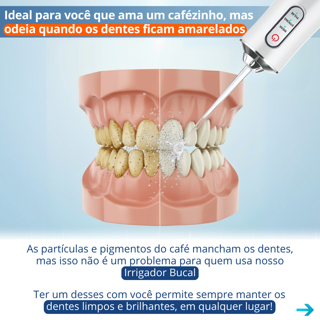 Aparelho Irrigador Oral Bucal Dental Jet Limpeza Portátil