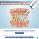 Aparelho Irrigador Oral Bucal Dental Jet Limpeza Portátil
